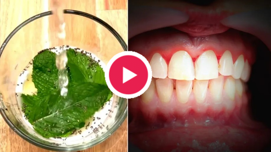 The-60-Second-Discovery-That-Ended-My-Years-Of-Bleeding-Gums-&-Saved-Me-$$$$-In-Dental-Bills